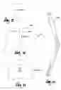 Fig. 04 - Counterforce brace