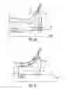Fig. 05 - Apparatus and methods for preventing and/or healing pressure ulcers