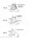 Fig. 07 - Apparatus and methods for preventing and/or healing pressure ulcers