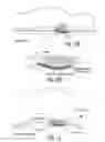 Fig. 30 - Apparatus and methods for preventing and/or healing pressure ulcers