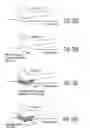Fig. 33 - Apparatus and methods for preventing and/or healing pressure ulcers