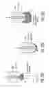 Fig. 35 - Apparatus and methods for preventing and/or healing pressure ulcers