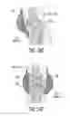Fig. 37 - Apparatus and methods for preventing and/or healing pressure ulcers