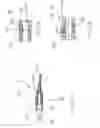 Fig. 03 - Combined fixed volume retention cuff and relief valve