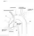 Fig. 08 - Catheter assembly