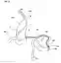 Fig. 09 - Catheter assembly