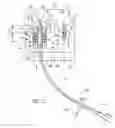 Fig. 03 - Catheter anchoring system