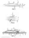 Fig. 03 - Valved intradermal delivery device and method of intradermally delivering a substance to a patient
