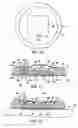 Fig. 06 - Valved intradermal delivery device and method of intradermally delivering a substance to a patient