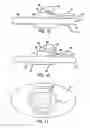 Fig. 08 - Valved intradermal delivery device and method of intradermally delivering a substance to a patient