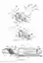 Fig. 06 - Apparatus and method for percutaneous catheter implantation and replacement