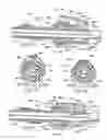 Fig. 07 - Apparatus and method for percutaneous catheter implantation and replacement