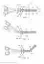 Fig. 02 - Surgical clamp having transmurality assessment capabilities
