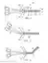 Fig. 02 - Surgical clamp having trasmurality assessment capabilities