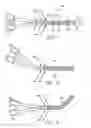 Fig. 02 - Surgical clamp having trasmurality assessment capabilities
