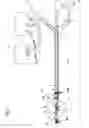 Fig. 02 - Balloon catheter