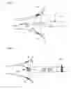 Fig. 05 - Balloon catheter