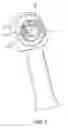 Fig. 04 - Aspirating electrosurgical probe with aspiration through electrode face