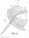 Fig. 10 - Aspirating electrosurgical probe with aspiration through electrode face