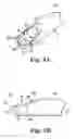 Fig. 04 - Method and apparatus for removing material from an intervertebral disc space, such as in performing a nucleotomy