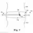 Fig. 08 - Method and apparatus for removing material from an intervertebral disc space, such as in performing a nucleotomy