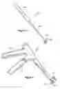 Fig. 07 - Method for resurfacing a lumbar articular facet
