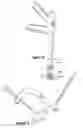 Fig. 08 - Method for resurfacing a lumbar articular facet