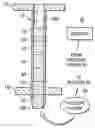 Fig. 01 - Surgical apparatus and method for manipulating one or more osteochondral plugs