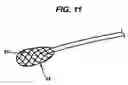Fig. 09 - Vessel wound closure device