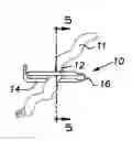 Fig. 01 - Vascular and intestinal occlusion