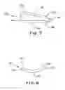 Fig. 04 - Vascular and intestinal occlusion