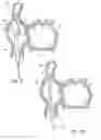 Fig. 09 - Method for accessing the left atrial appendage with a balloon-tipped transeptal sheath