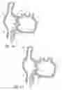 Fig. 12 - Method for accessing the left atrial appendage with a balloon-tipped transeptal sheath
