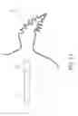 Fig. 14 - Method for accessing the left atrial appendage with a balloon-tipped transeptal sheath