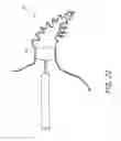 Fig. 19 - Method for accessing the left atrial appendage with a balloon-tipped transeptal sheath