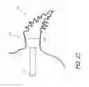 Fig. 22 - Method for accessing the left atrial appendage with a balloon-tipped transeptal sheath