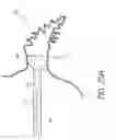 Fig. 23 - Method for accessing the left atrial appendage with a balloon-tipped transeptal sheath