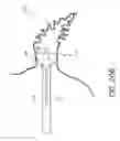 Fig. 24 - Method for accessing the left atrial appendage with a balloon-tipped transeptal sheath