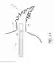 Fig. 25 - Method for accessing the left atrial appendage with a balloon-tipped transeptal sheath