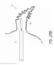 Fig. 27 - Method for accessing the left atrial appendage with a balloon-tipped transeptal sheath
