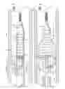 Fig. 03 - Single-wire expandable cages for embolic filtering devices