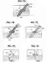 Fig. 07 - Systems and methods for closing a vessel wound