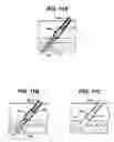 Fig. 10 - Systems and methods for closing a vessel wound
