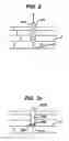 Fig. 03 - Systems and methods for closing a vessel wound