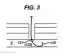 Fig. 04 - Systems and methods for closing a vessel wound