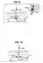 Fig. 10 - Systems and methods for closing a vessel wound