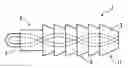 Fig. 01 - Suture anchor with insert-molded suture eyelet