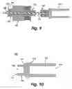 Fig. 06 - Electromechanical adjusting instrument