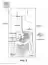 Fig. 04 - Transvisceral neurostimulation mapping device and method