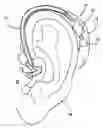 Fig. 01 - Non-invasive device and method for electrical stimulation of neural tissue